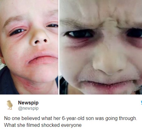 Kein Arzt glaubt der Mutter, was mit ihrem 6-Jährigen Sohn passiert. Doch was sie filmt, öffnet ihnen die Augen.