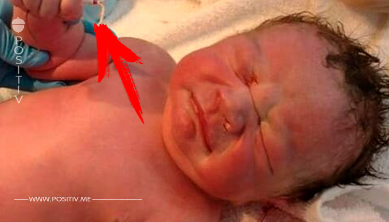 Ärzte sind sprachlos bei Geburt: Was Sie in der Hand des Babys sehen kann keiner glauben	