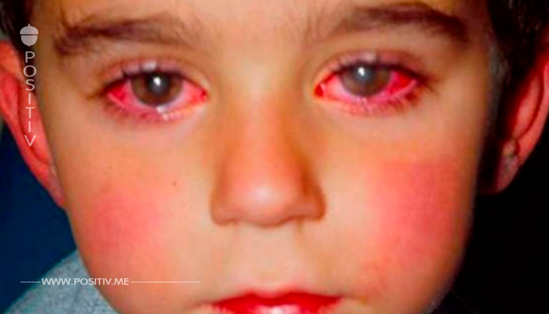 Ein Kind verlor 75% seines Augenlichts wegen nur eines einzigen Lämpchens. Das MUSS geteilt werden!	