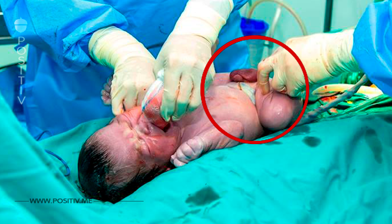 Arzt bringt schreiendes Baby zur Welt – guckt ein 2. Mal auf Nabelschnur und rennt zur Kamera	