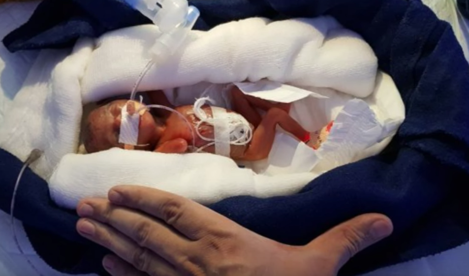 Baby mit einem Gewicht von nur 400 Gramm wird von Ärzten zum Tode verurteilt – dann sehen sie das Detail auf ihrem Fuß