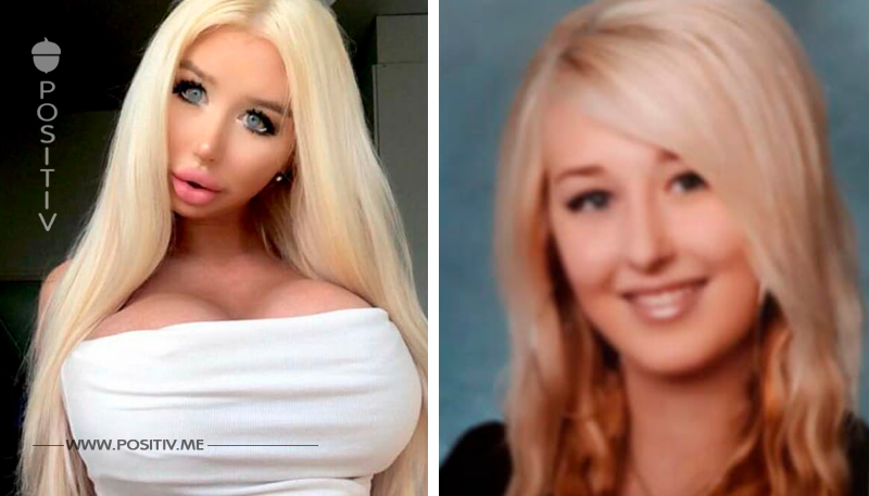 Amanda, 22, hat 50.000 Euro dafür ausgegeben, um Barbie zu werden - jetzt sind die Brüste beim Schminken im Weg