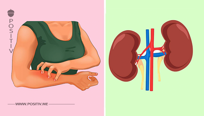 Dein Körper warnt dich, bevor du krank wirst: 8 Anzeichen, dass die Nieren Hilfe brauchen
