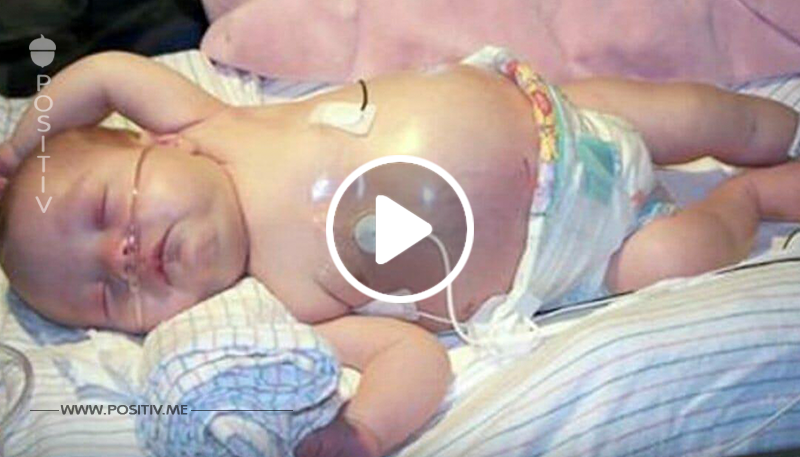 Ärzte sehen etwas im Bauch eines Babys wachsen: entdecken das gleiche Ding in Schwester