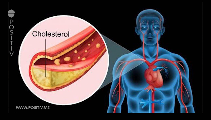 7 wichtige Faktoren, die den Cholesterinwert im Blut erhöhen