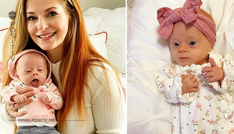 Mutter teilt ehrliche ‚Rezension‘ von ihrem Baby mit Down Syndrom   354 Tausend Menschen lieben es