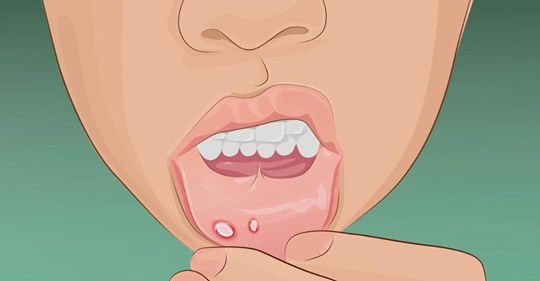8 Dinge, die deine Lippen über deine Gesundheit verraten