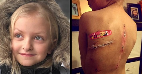 Krebsüberlebende 8-Jährige lernt Narben zu lieben
