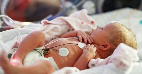 Zwillings-Frühchen kommen 15 Wochen zu früh zur Welt – Stärkerer soll Bruder mit Umarmung gerettet haben