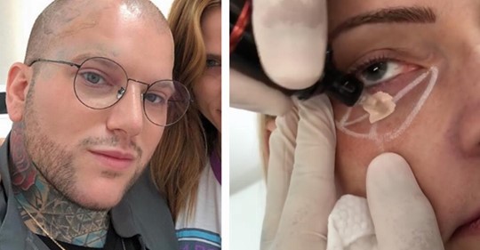 Permanent Make up: Mann kaschiert mit Tattoos Augenringe und Dehnungsstreifen