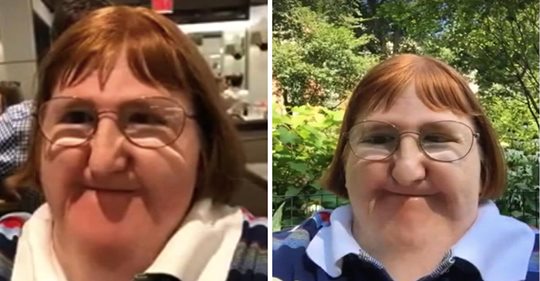 Frau mit Behinderung, der gesagt wird, sie sei  zu hässlich  um Selfies zu machen, lässt sich nicht von negativen Kommentaren schikanieren