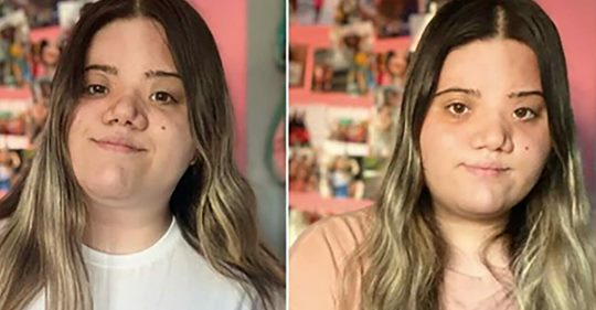 20-Jährige wird für anders aussehendes Gesicht in den sozialen Medien gehänselt – schlägt mit Video zurück