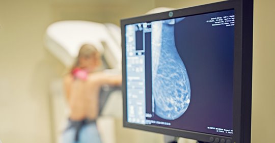 Mammographie: Ab wann Frauen zum Screening sollten
