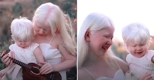 Albino-Schwestern mit einem Altersunterschied von zwölf Jahren werden mit Modellfotos im Internet berühmt