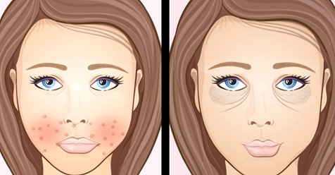 9 Gesichts-Symptome zeigen, ob du krank bist