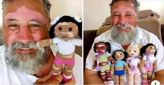 Dieser Opa häkelt Puppen mit Vitiligo Hautkrankheit, um Kinder mit der gleichen Krankheit aufzuheitern