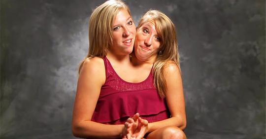 Siamesische Zwillinge Abby und Brittany Hensel werden als Mathelehrerinnen in Minnesota eingestellt