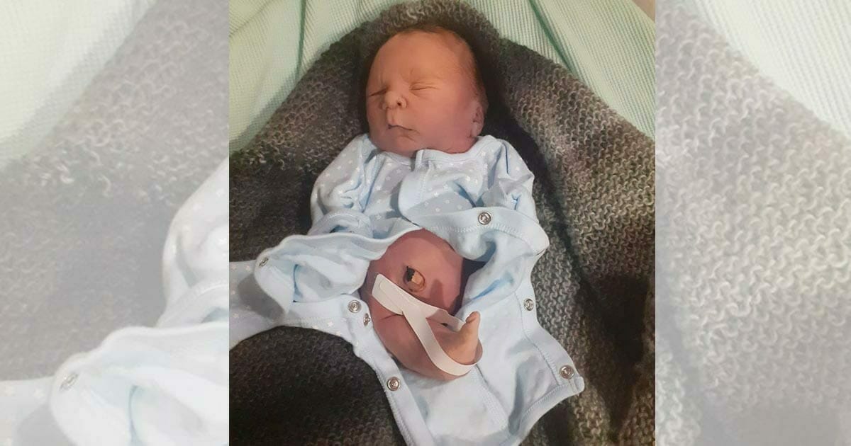 Baby wird mit „Meerjungfrauenbeinen“ und ohne Darm geboren – nimmt am nächsten Tag in Papas Schoß letzten Atemzug