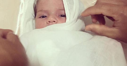 Piebaldismus: Baby Mayah wird mit weißer Strähne geboren